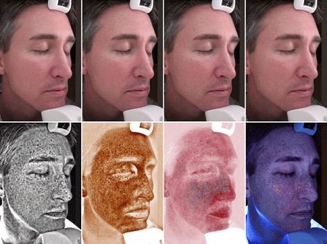 Results of facial analysis using visiatm