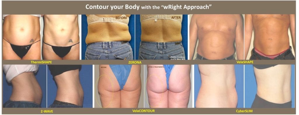 Transform Your Body at Sculpture Line Body Contouring Today