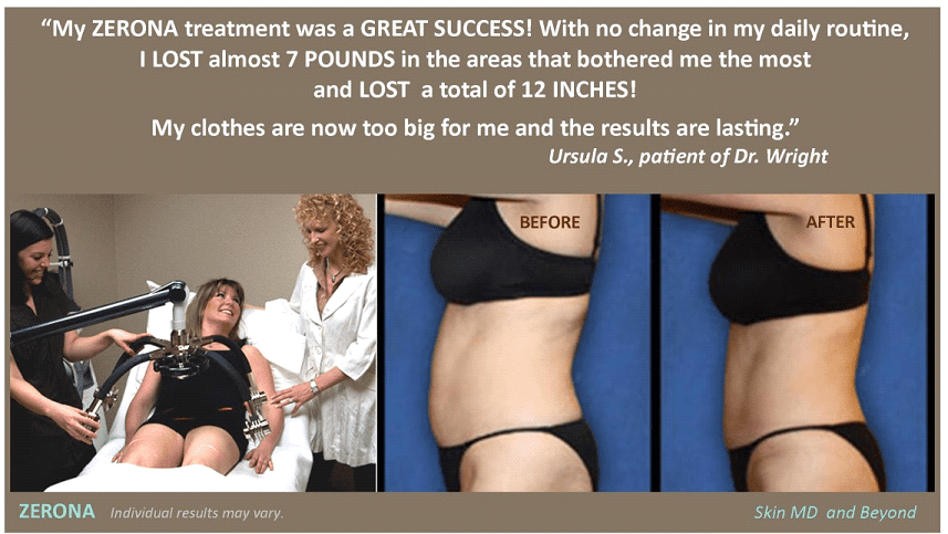 Laser Lipo Vs Body Contouring in McKinney, TX: Cost, & Results