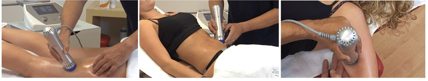 Z-Wave Austin, TX, Cellulite Reduction